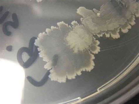 Bacillus subtilis bacterial colonies grown on TSY agar | Microbiology, Science images, Bacillus ...