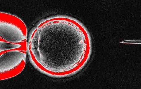 Cloning Is Used to Create Embryonic Stem Cells - NYTimes.com