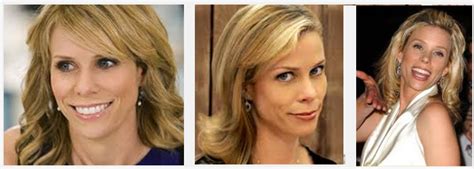 Cheryl Hines Plastic Surgery Before and After - Plastic Surgery Photos