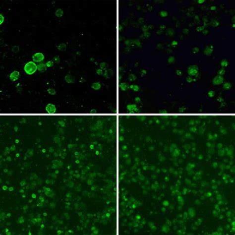 Microscopy of varicella-zoster virus-infected cells used in the... | Download Scientific Diagram