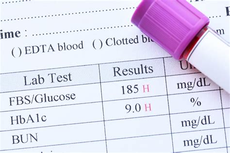 Hyperglycemia May Worsen Outcomes of Intravenous Thrombolysis in Patients With Acute Ischemic ...