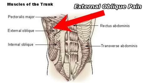 external oblique pain - Physiqz