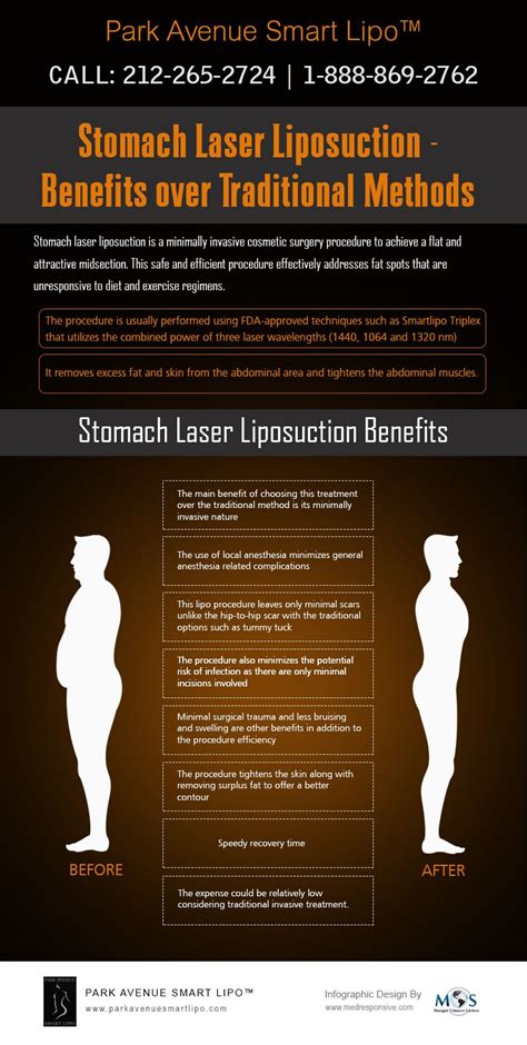 Stomach Laser Liposuction – Benefits over Traditional Methods [Infographic] | Laser liposuction ...