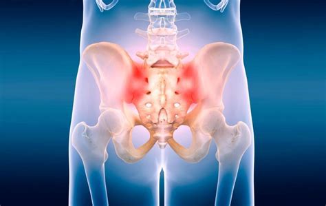 Dysfunction in the Sacroiliac Joint: Timothy Spencer, DO: Minimally Invasive Spine Surgeon