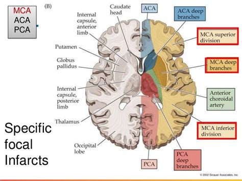 Pathology of Stroke & CVA