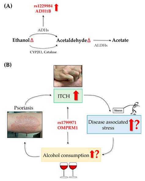 IJMS | Free Full-Text | Alcohol in Psoriasis—From Bench to Bedside