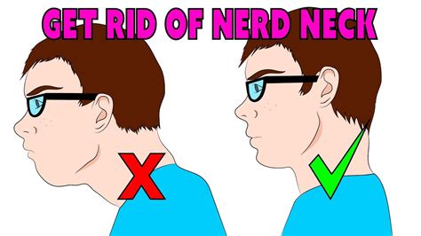 exercises for nerd neck > OFF-59%