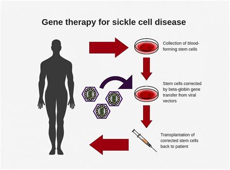 What Happens During Genetic Therapy? - StoryMD