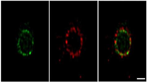 Scientists Study Bacterial Cell Division