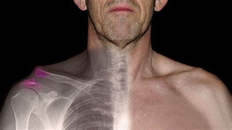 Shoulder - Physical Therapy in Asheville NC