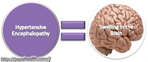 Hypertensive Encephalopathy - Stepwards