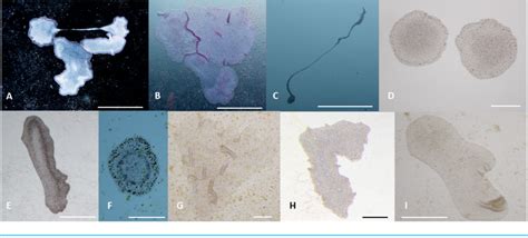 Figure 5 from Trichoplax adhaerens reveals a network of nuclear ...