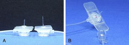 26. Alternative Infusion Access Devices | Nurse Key