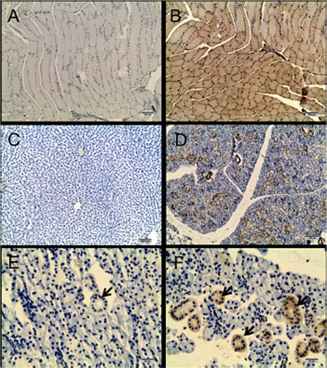 Immunodetection of GLUT4 transporter in rat tissues with a mouse... | Download Scientific Diagram