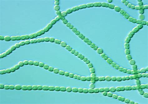 Cyanobacteria | Chains of cyanobacteria, also known as blue-… | Flickr