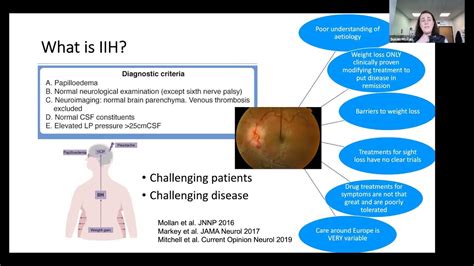 IDIOPATHIC INTRACRANIAL HYPERTENSION – PATHOPHYSIOLOGY AND CSF DIVERSION - YouTube