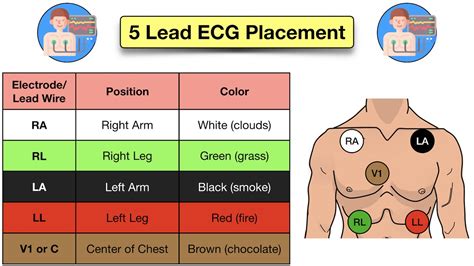 How to Place a 5 Lead ECG: Acronym, Mnemonic, Diagram for Electrode Placement Explained — EZmed