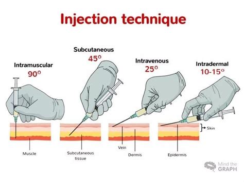 Injection Technique : r/nursing