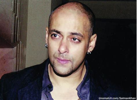 Salman khan | Hair transplant, Bollywood actors, Hair