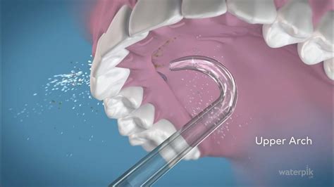 Waterpik® Implant Denture Tip (UK) - YouTube