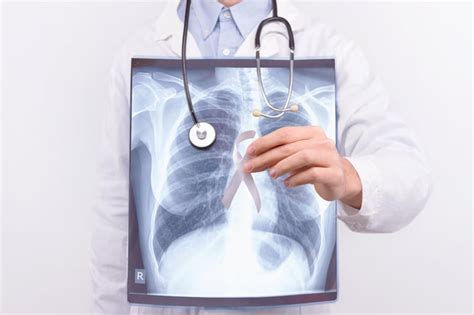 Opdivo May Bring Survival Boost for Lung Cancer Patients – A2Z Facts