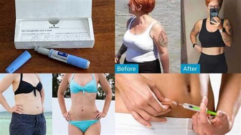 Ozempic Weight Loss Before and After Pictures - Best Health Insider