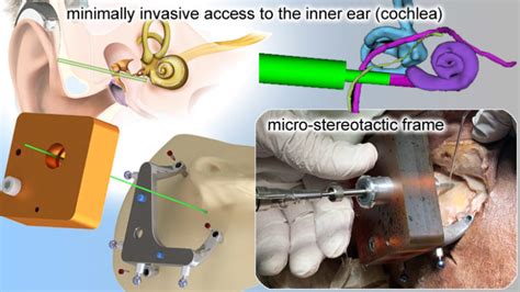 Ex vivo evaluation of a minimally invasive approach for cochlear ...