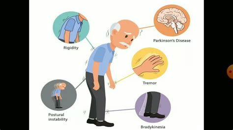 Antiparkinson drugs Pharmacology - YouTube