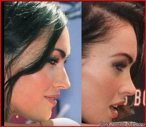 Megan Fox Plastic Surgery Pictures Revealed - Celebrities Plastic Surgery