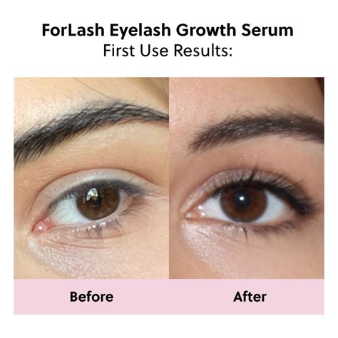 Lash Serum - ForChics