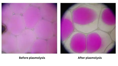 Plasmolysis - Definition, Stages, Functions, Examples, - Biology Notes ...