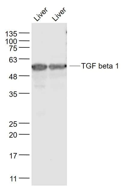 TGF beta 1 Antibody (BS-0086R)