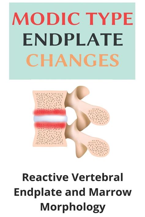 Buy Modic Type Endplate Changes: Reactive Vertebral Endplate And Marrow ...