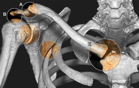 Imaging of the Acromioclavicular Joint: Anatomy, Function, Pathologic Features, and Treatment ...