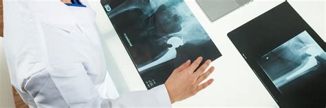 Hip Replacement vs Hip Resurfacing | Rothman Orthopaedics