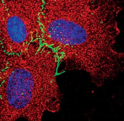 VE-cadherin Antibody (PA5-17401)