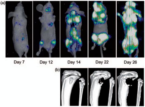 Imaging model of bone metastasis from breast cancer. (a) Serial... | Download Scientific Diagram