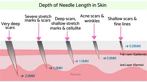 How To Dermaroll Safely At Home - Rejuviss | Skin needling, Microneedling, Dermatology skin care