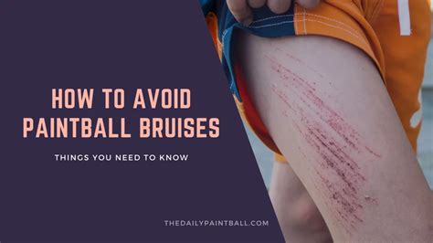 Tips to avoid Paintball Bruises (May 2022) - What really Works