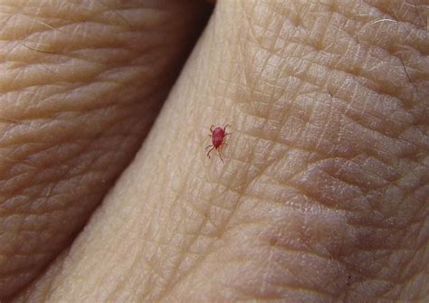 Chigger Bites: What They Look Like, Prevention, Treatment | The Healthy