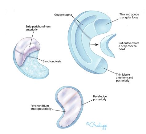 External Ear – Oto Surgery Atlas