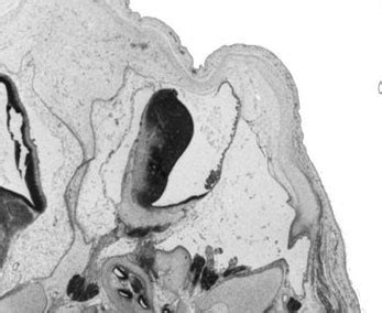 Neural - Cerebellum Development - Embryology