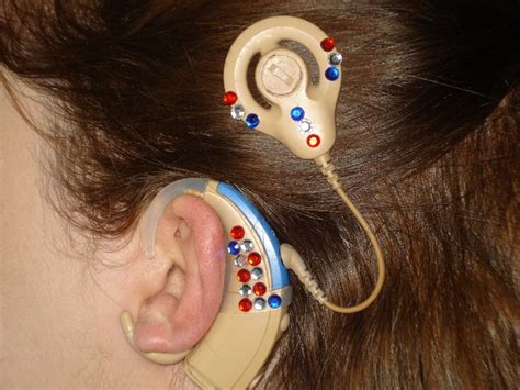 Cochlear Implant Decoration | Cochlear implant decoration, Cochlear, Cochlear implant