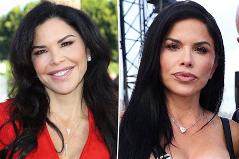 Lauren Sanchez Plastic Surgery: Before and After Looks - Stanford Arts ...