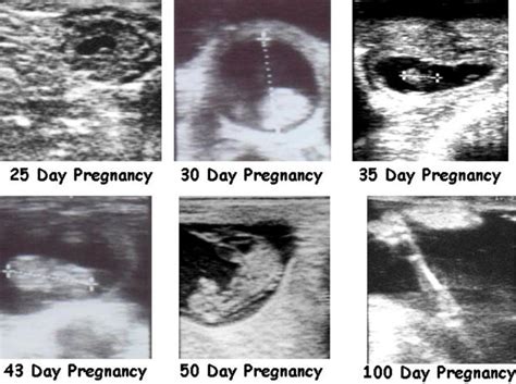 AN113/AN113: Practical Uses for Ultrasound in Managing Beef Cattle Reproduction