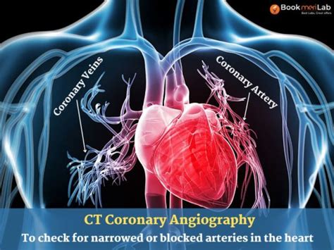 CT Coronary Angiography: Purpose, Procedure, Report & Price [2024]