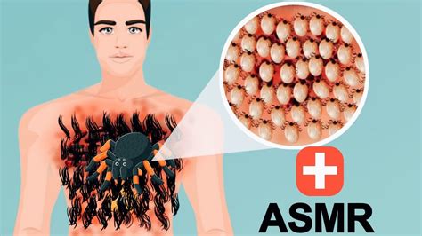 ASMR Removes chest hair And treatment | stop motion 2D Animation ...