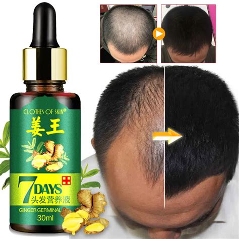 Aliexpress.com : Buy Ginger Hair Growth Essential Oil 30ML Anti Hair Loss Care regeneration ...