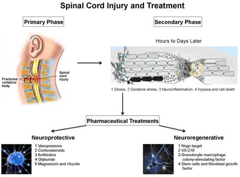 Treatment for spinal cord injury – Atlas of Science