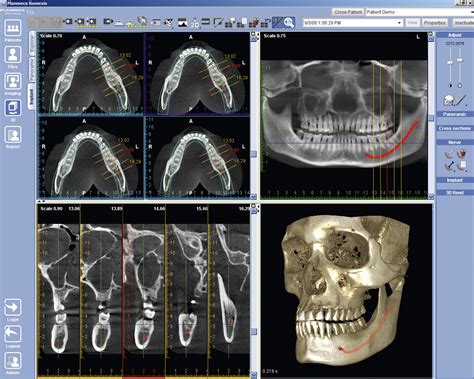 Planmeca Romexis Software Reviews, Demo & Pricing - 2024